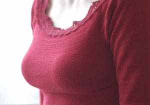augmentation-mammaire-seins